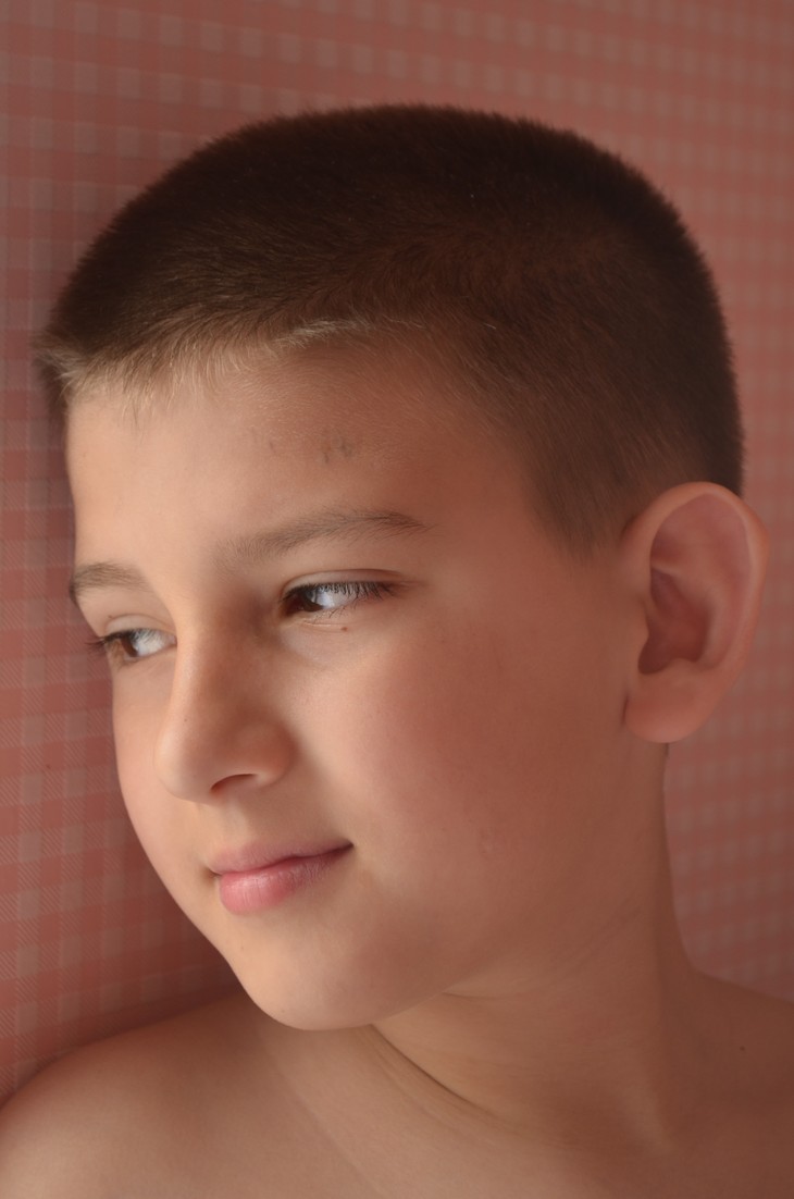 Image-normal